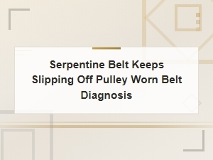 Why Your Serpentine Belt Keeps Slipping Off